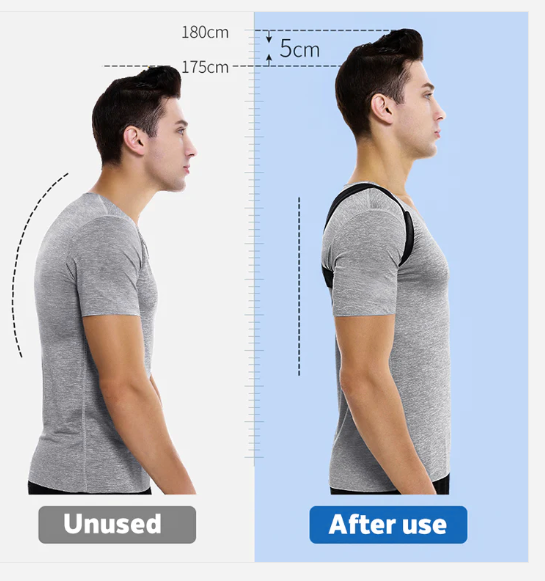 Posture corrector